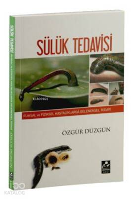 Sülük Tedavisi Ruhsal ve Fiziksel Hastalıklarda Geleneksel Tedavi - 1